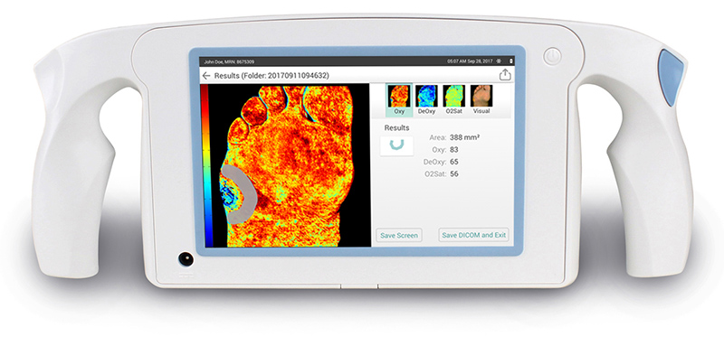 Imaging Screen to Assess Tissue Oxygenation